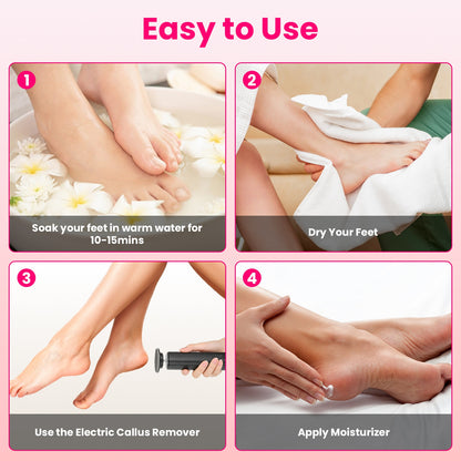 2 In 1 Electric Foot Callus Remover