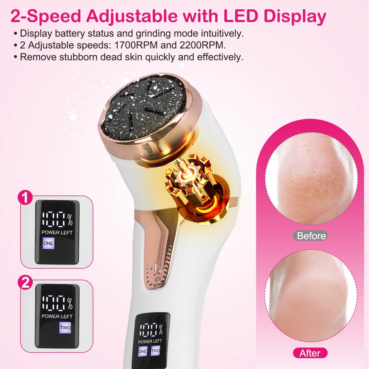 17Pcs Electric Foot Callus Remover with Vacuum Foot Grinder